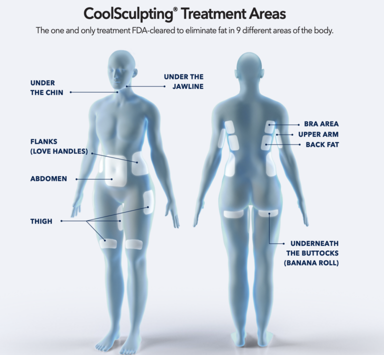 CoolSculpting Treatment Areas Minneapolis